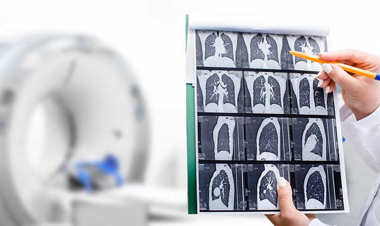 Clinician showing CT scan of a patient’s lungs in front of a CT machine