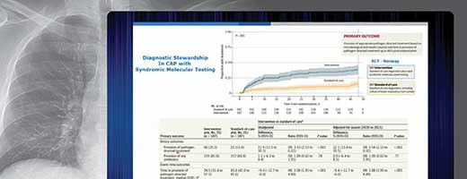 Community-Acquired Pneumonia in Hospitalized Patient