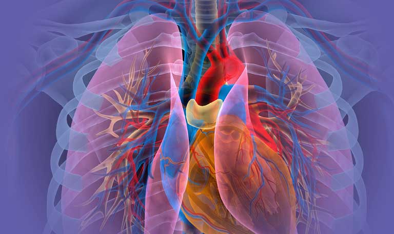 Illustration showing pulmonary hypertension