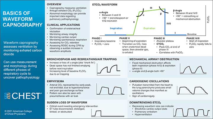 Capnography infographic