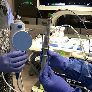 A person holds a EBUS transbronchial needle