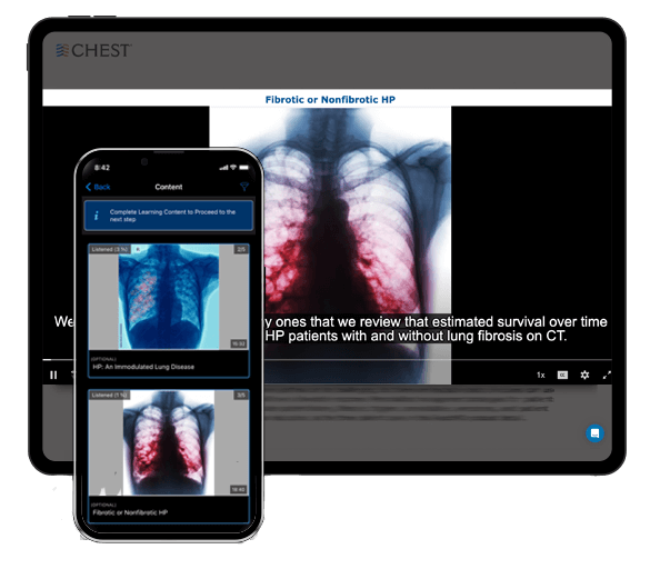 CHEST Curriculum Pathway for Interstitial Lung Disease on devices