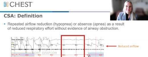 Screenshot from the CSA webinar