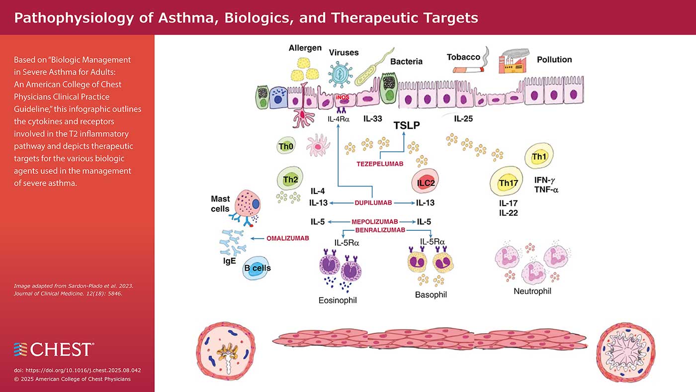 Pathophysiology of Asthma, Biologics, and Therapeutic Targets infographic