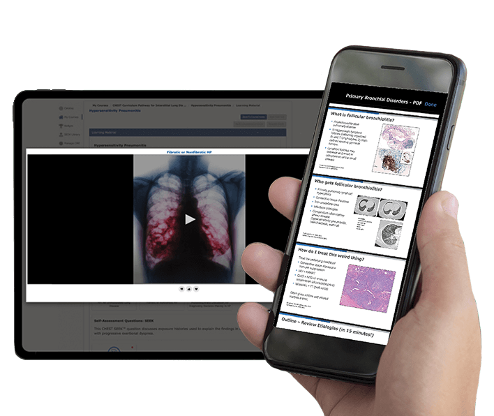 Screenshots of CHEST Curriculum Pathway products on a laptop, tablet, and phone