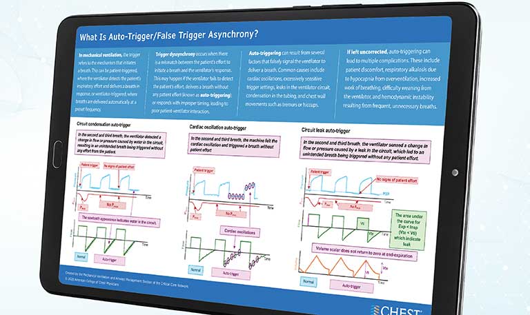Screenshot of the Auto-Trigger/False Trigger Asynchrony infographic on a tablet