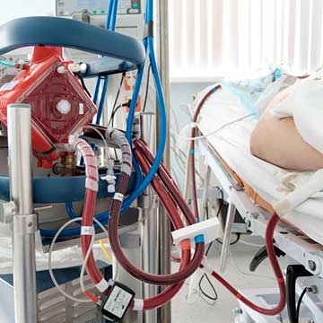 Extracorporeal membrane oxygenation machine