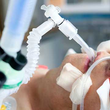 An intubated person