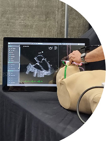 Critical Care Transesophageal Echocardiography June 2026